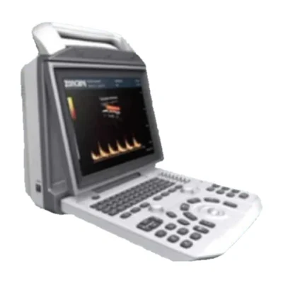 Portable ultrasound scanner